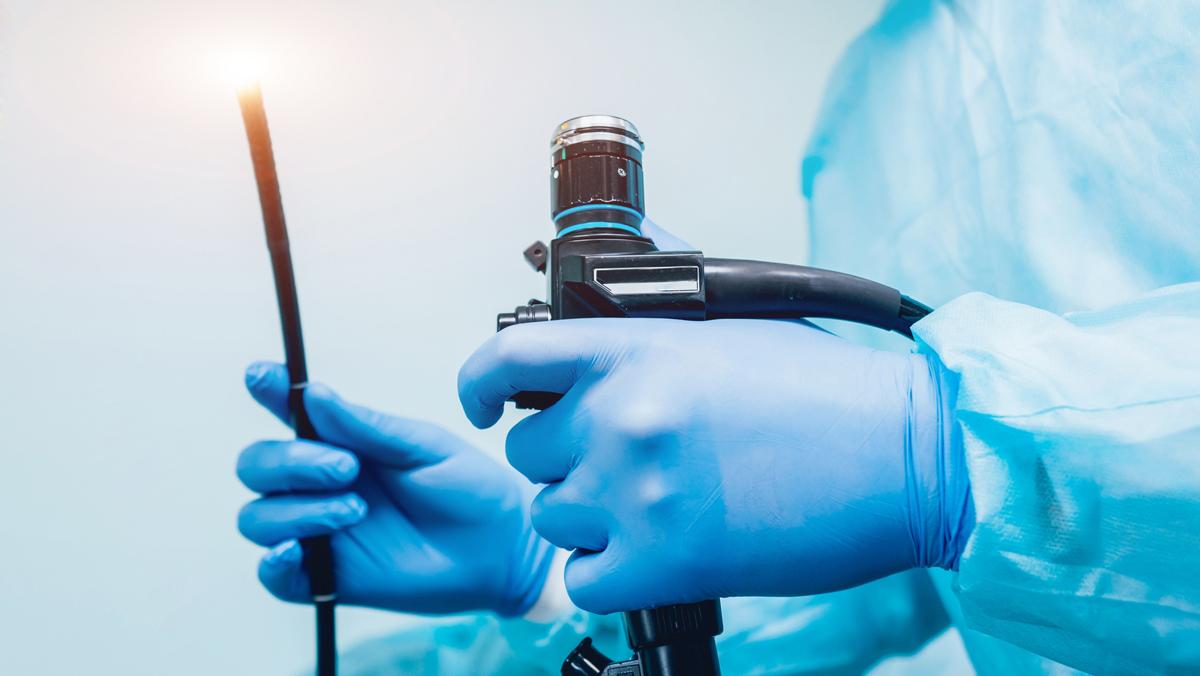 Endoscopy